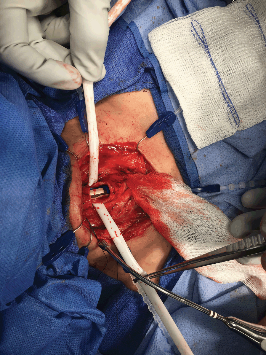 Nasty Surgeons Open Cadavers Full Ep
